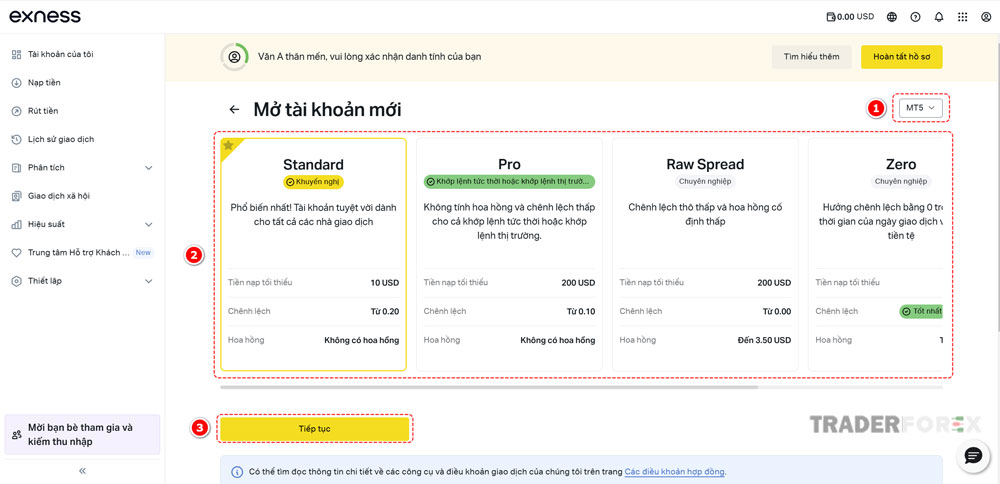 chon-option-cho-tai-khoan Lựa chọn loại tài khoản phù hợp